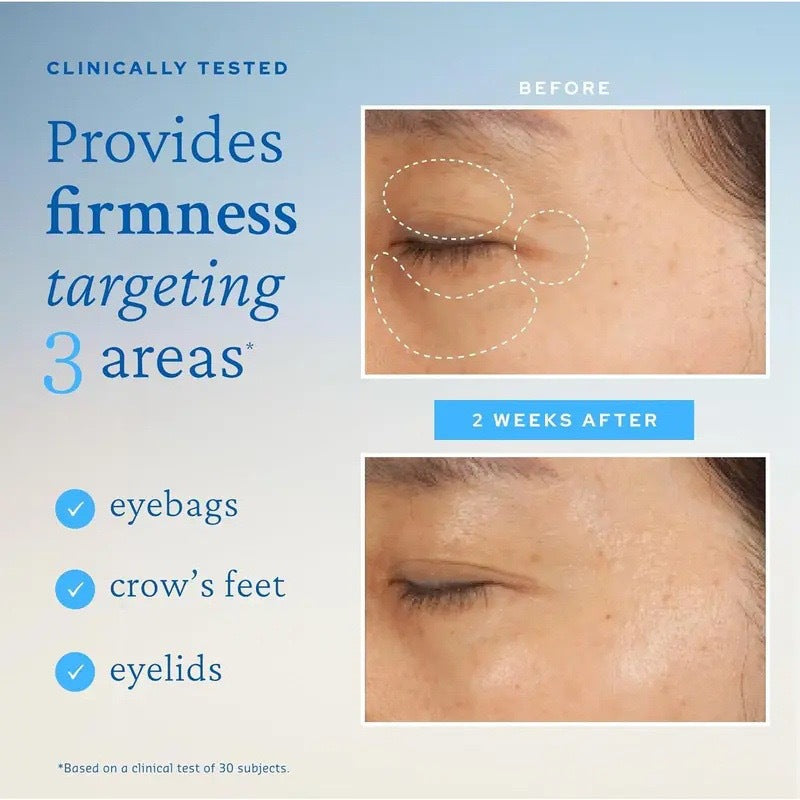 KYM Aqua Bomb Eye Gel