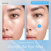 KYM Aqua Bomb Eye Gel