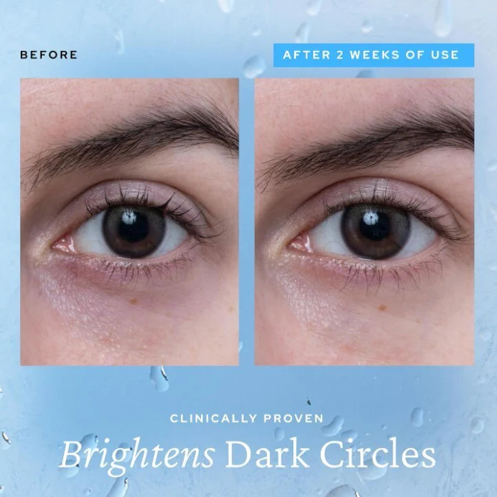 KYM Aqua Bomb Eye Gel